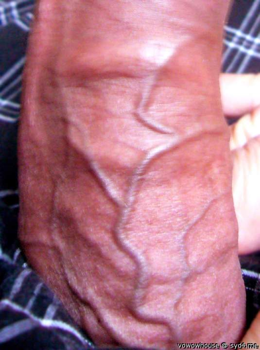 Blue Vein