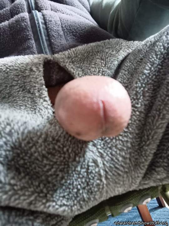 Photo of a prick from edwardren