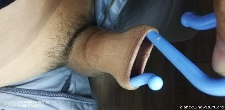 skin expension
