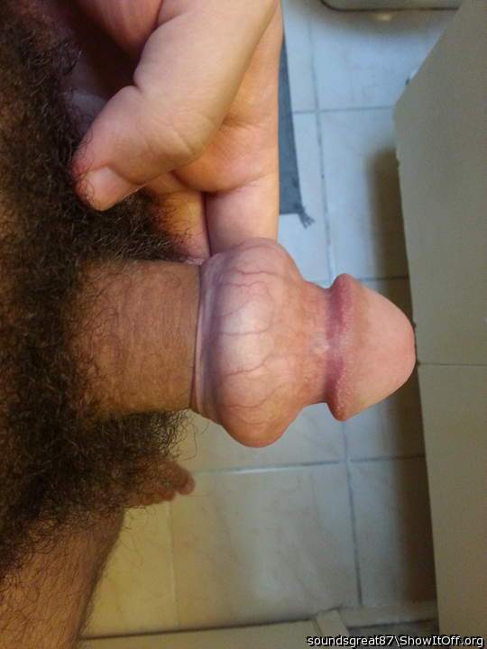 Foreskin rolled back over cockring