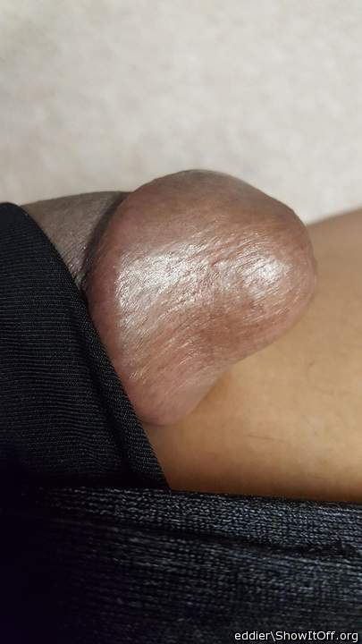 Photo of a middle leg from eddier