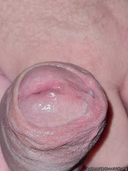 Glans