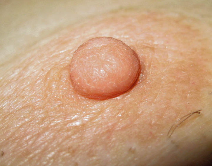 Nipple......
