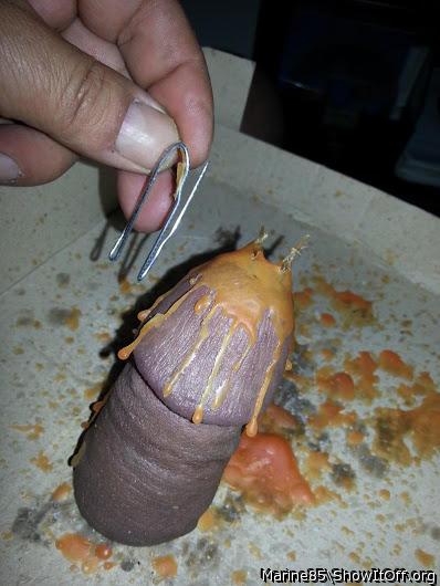Wax Filling