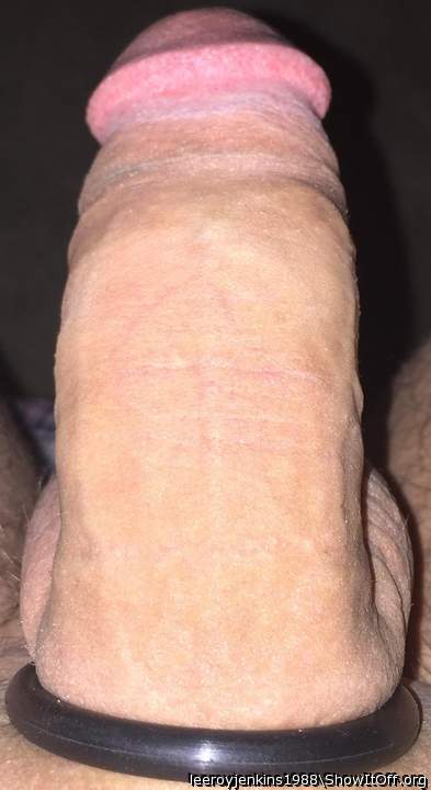 Photo of a penile from leeroyjenkins