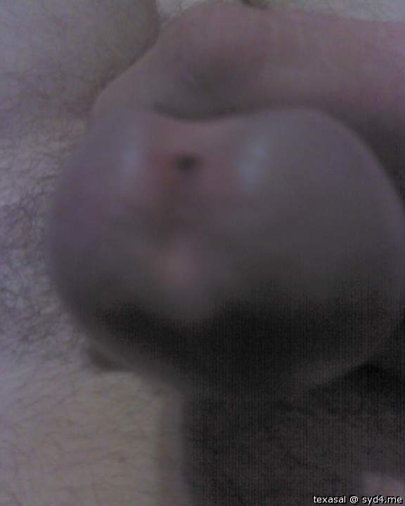 Photo of a short leg from texasal