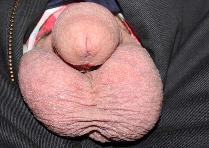 Photo of a penile from lilsoftee