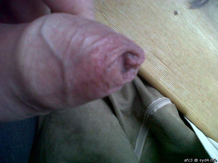 first pic