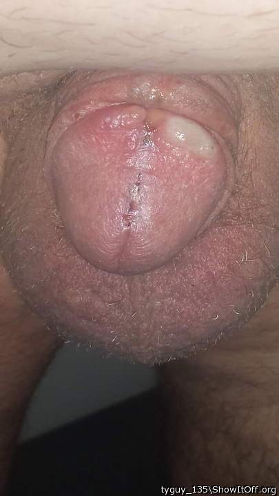 After Burn