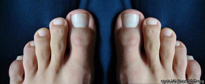apolo10   Toes