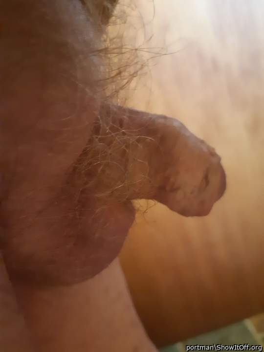 Hairy balls