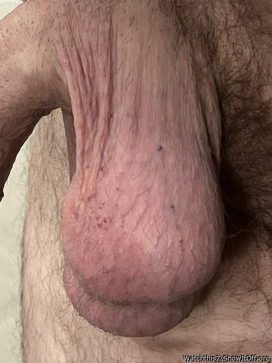 Testicles Photo from Watchthis2