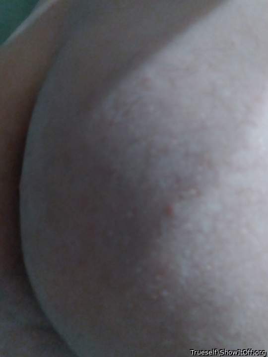Photo of a short leg from Trueself