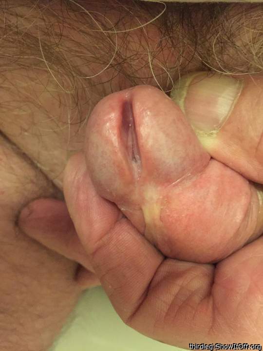 My split open