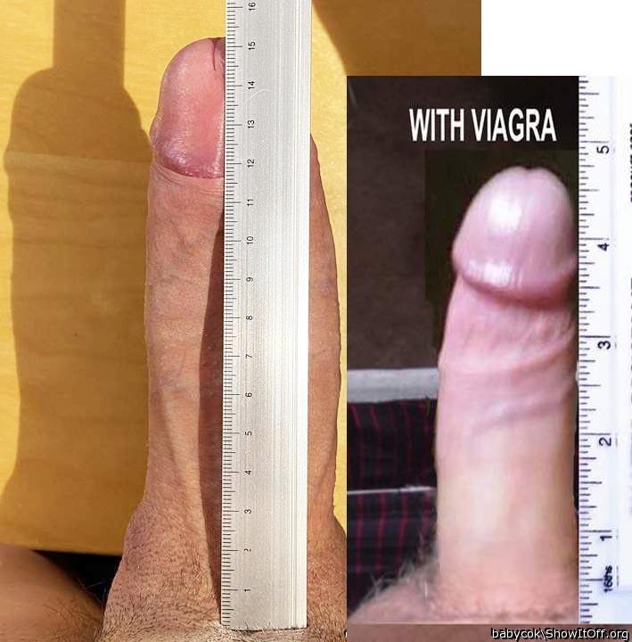 Photo of a third leg from babycok