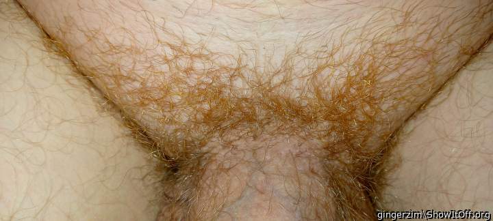Photo of a penile from gingerzim