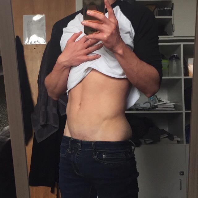Teasing