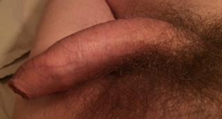 Photo of a private part from sweetee