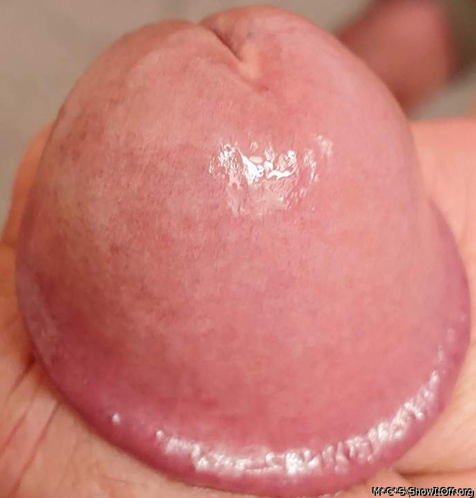 Photo of a prick from M*C*S