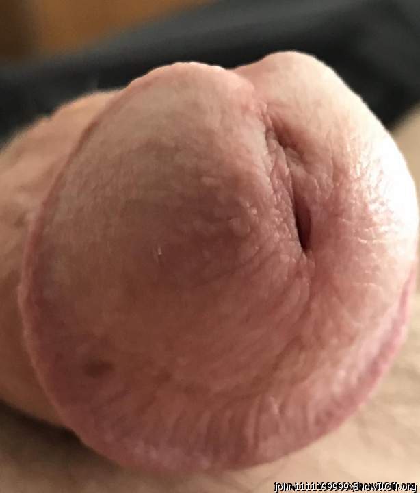 Photo of a wiener from John1111199999