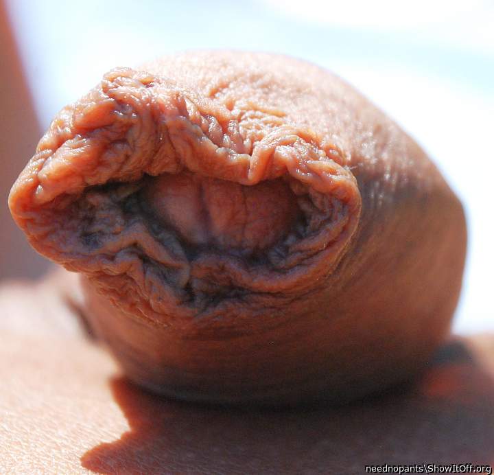 Gorgeous foreskin
