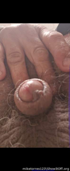 Photo of a prick from miketorres123