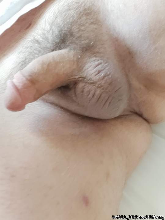 Photo of a third leg from Ant101_10