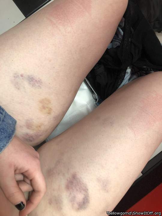 I wish this would happen again and more.. from biting