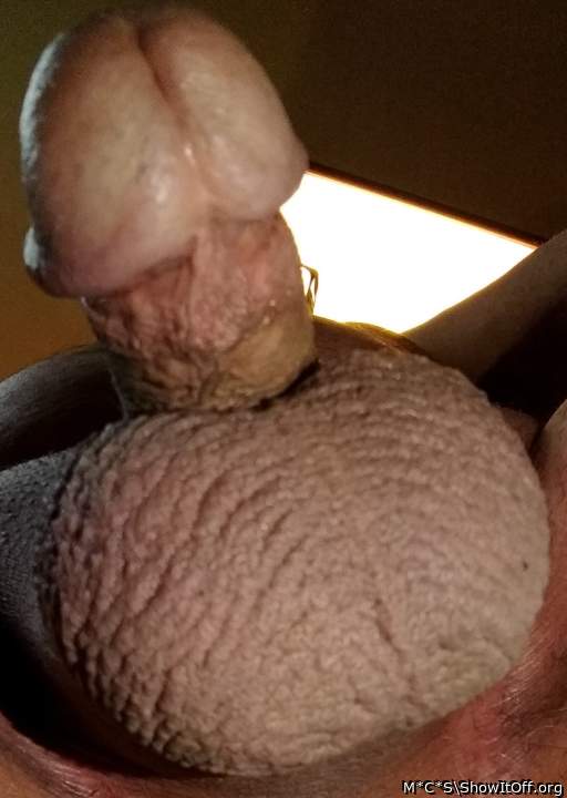 Testicles Photo from M*C*S
