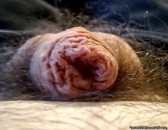 wrinkled foreskin3