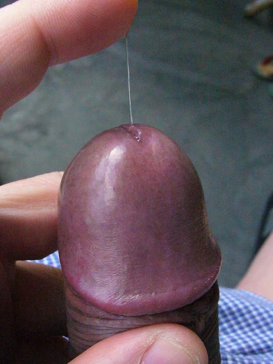 precum which pulls a thread