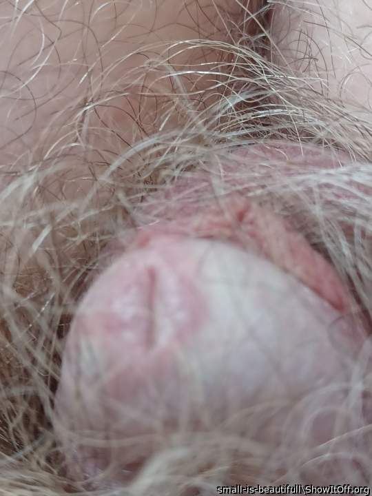 my glans penis