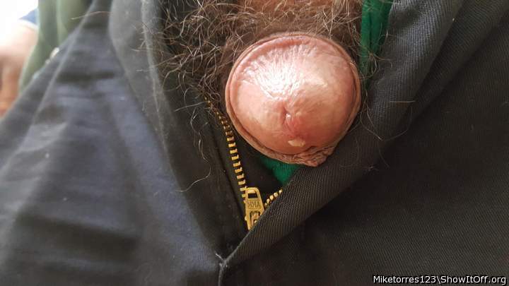 Photo of a penile from miketorres123