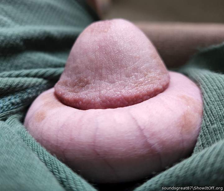 big ring, wrinkled glans