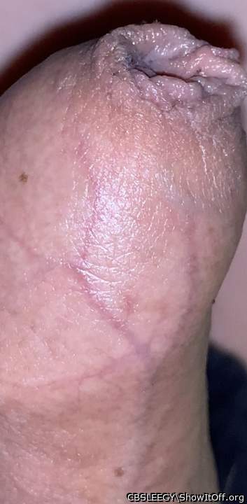 Photo of a prick from CBSLEEGY