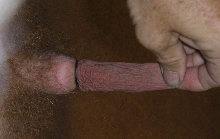 My penis, your foreskin! 