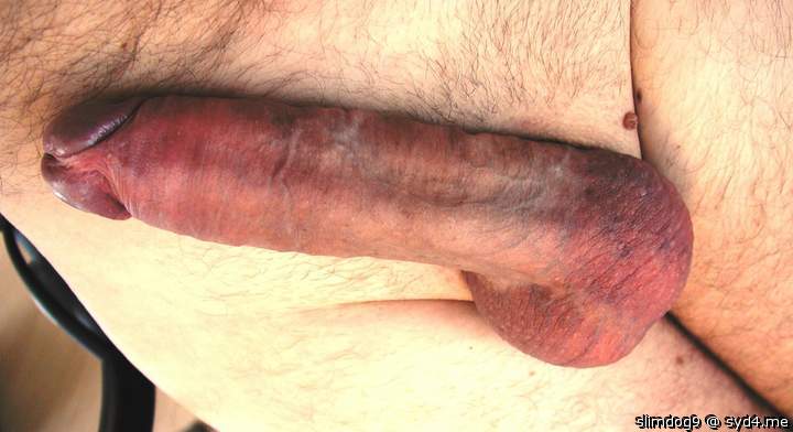 Photo of a penile from slimdog9