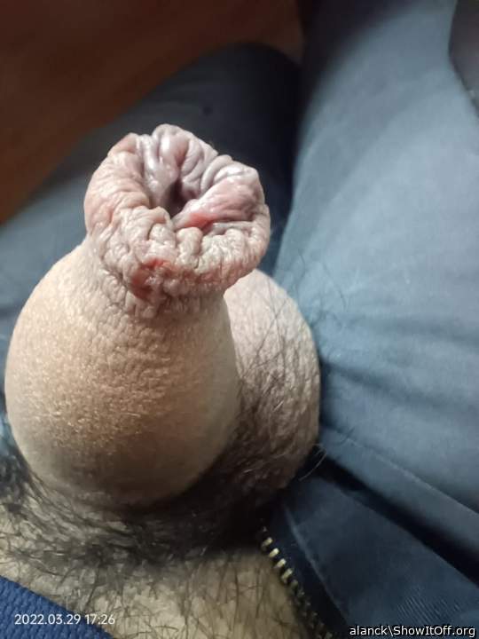 sweet foreskin 