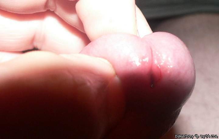 Photo of a penile from bakerboy