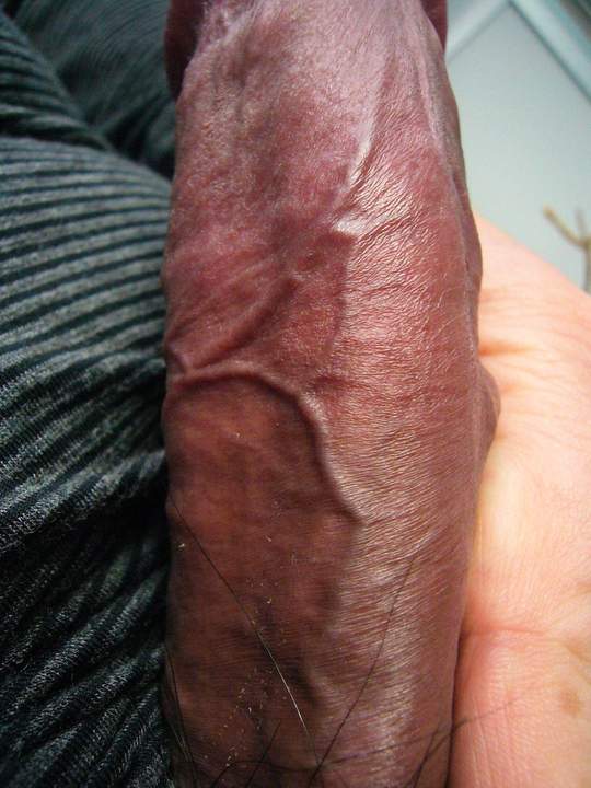 Masurao 1