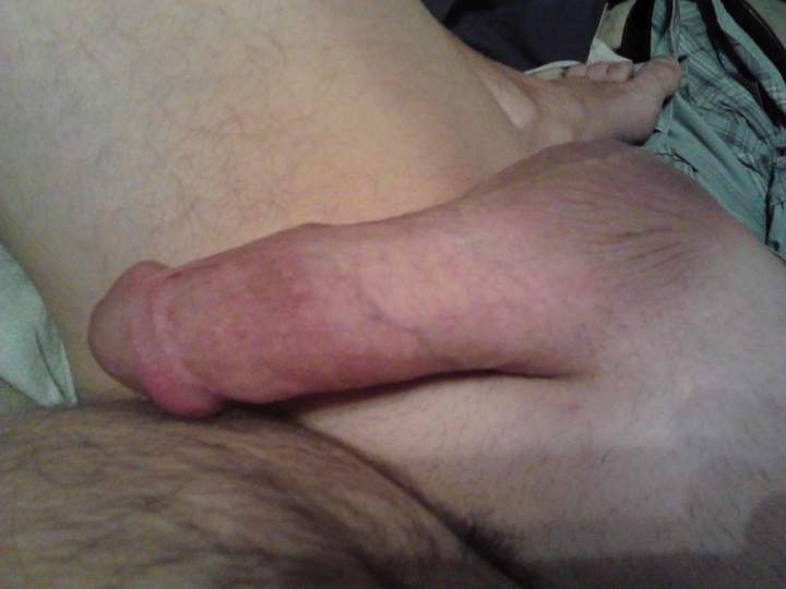 Photo of a penile from fish4free