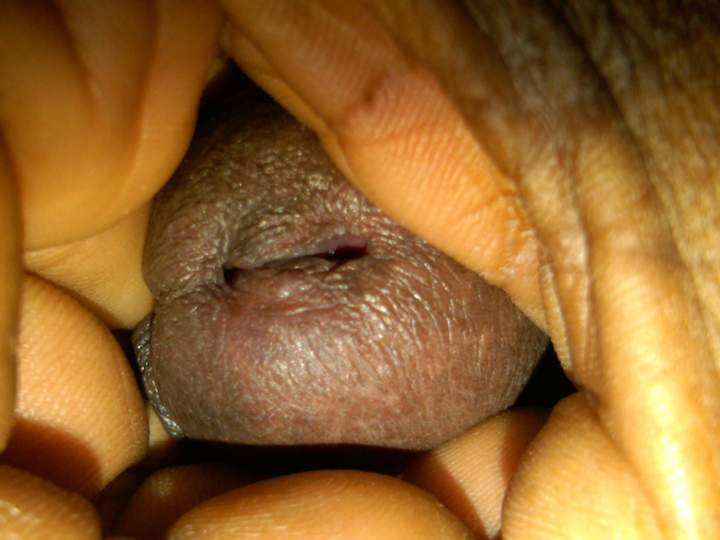 Photo of a prick from GaryMPLS72