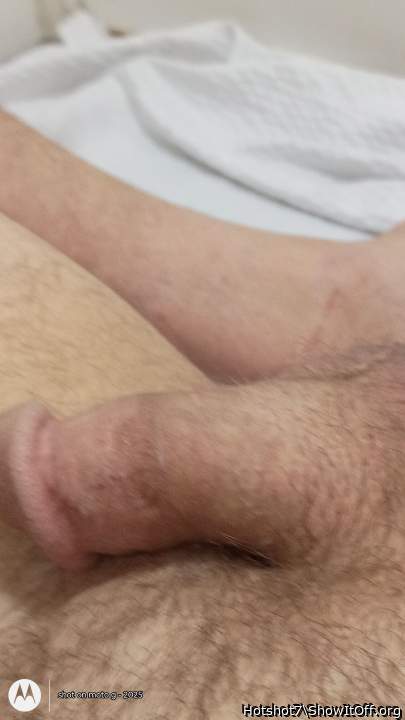 Photo of a penis from Hotshot7