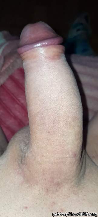 my dick normal
