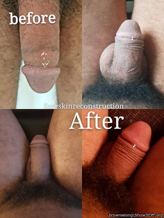 Photo of a penile from brownielong