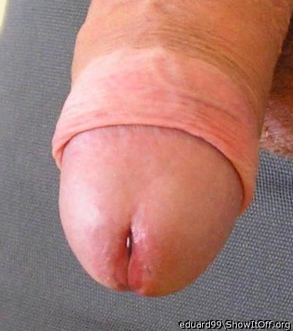 glans and foreskin for you