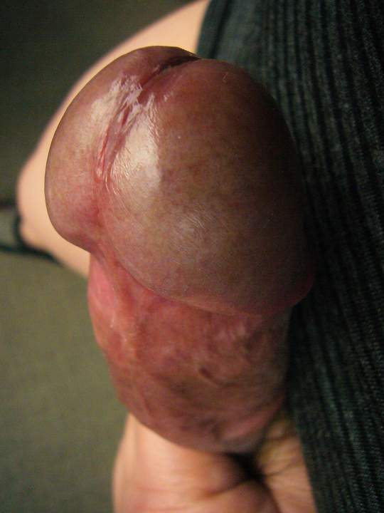 Nikugasa (&#32905;&#20632;)