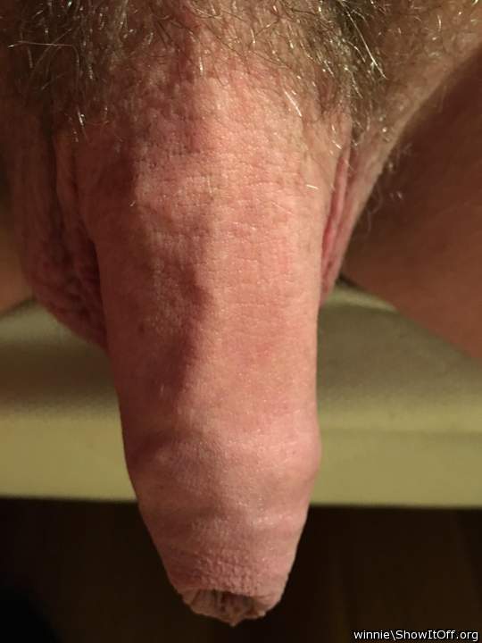 Photo of a phallus from winnie