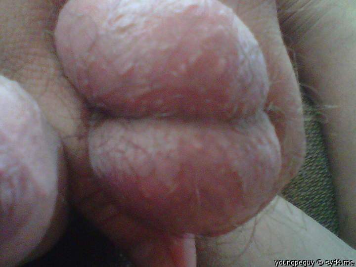 Testicles Photo from youngpeguy
