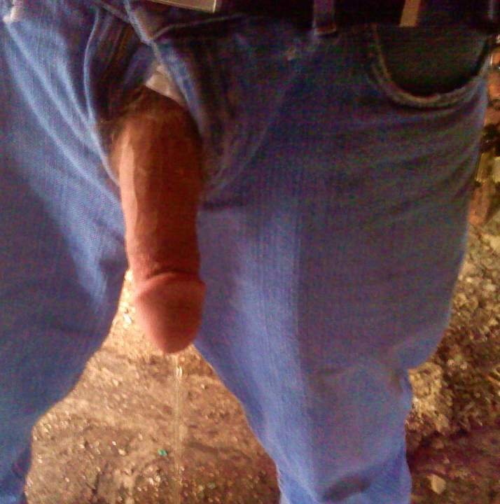 Photo of a short leg from jgengy